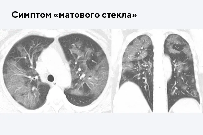 Асфиксия рыбок